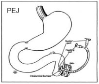 図４：PEG-Jの原理